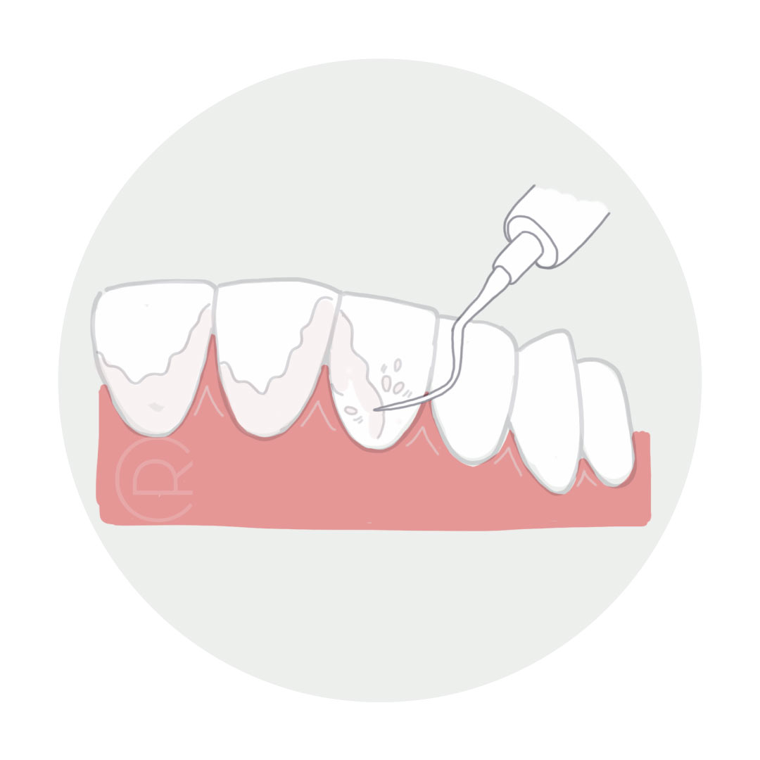 Control odontológico y limpieza dental profesional en consultorio