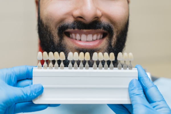 Guía de tonos para planificar un blanqueamiento dental con evaluación profesional